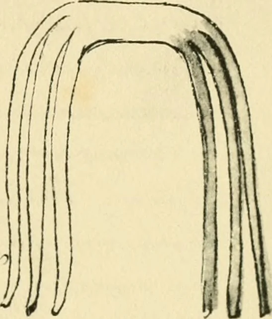 An illustration from Collection de chirurgiens grecs avec dessins attribués au Primatice. Reproduction réduite des 200 dessins du Manuscrit latin 6866 de la Bibliothèque nationale, 1908, leaf 106
