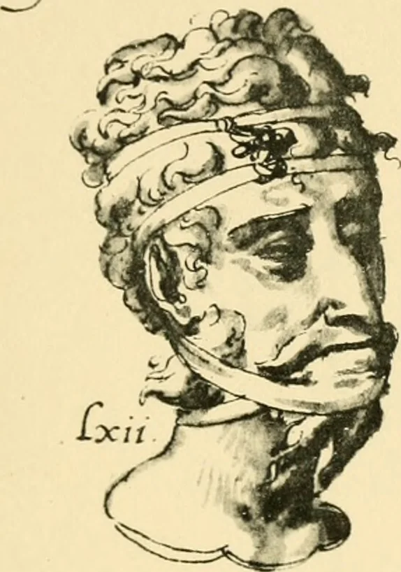 An illustration from Collection de chirurgiens grecs avec dessins attribués au Primatice. Reproduction réduite des 200 dessins du Manuscrit latin 6866 de la Bibliothèque nationale, 1908, leaf 108
