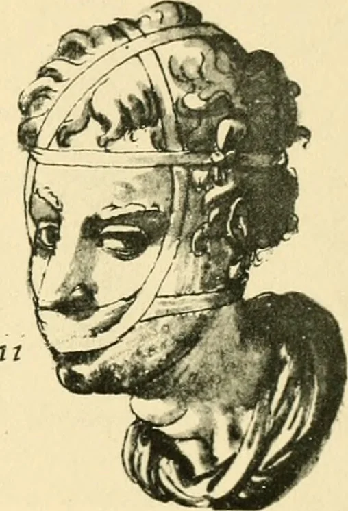 An illustration from Collection de chirurgiens grecs avec dessins attribués au Primatice. Reproduction réduite des 200 dessins du Manuscrit latin 6866 de la Bibliothèque nationale, 1908, leaf 108