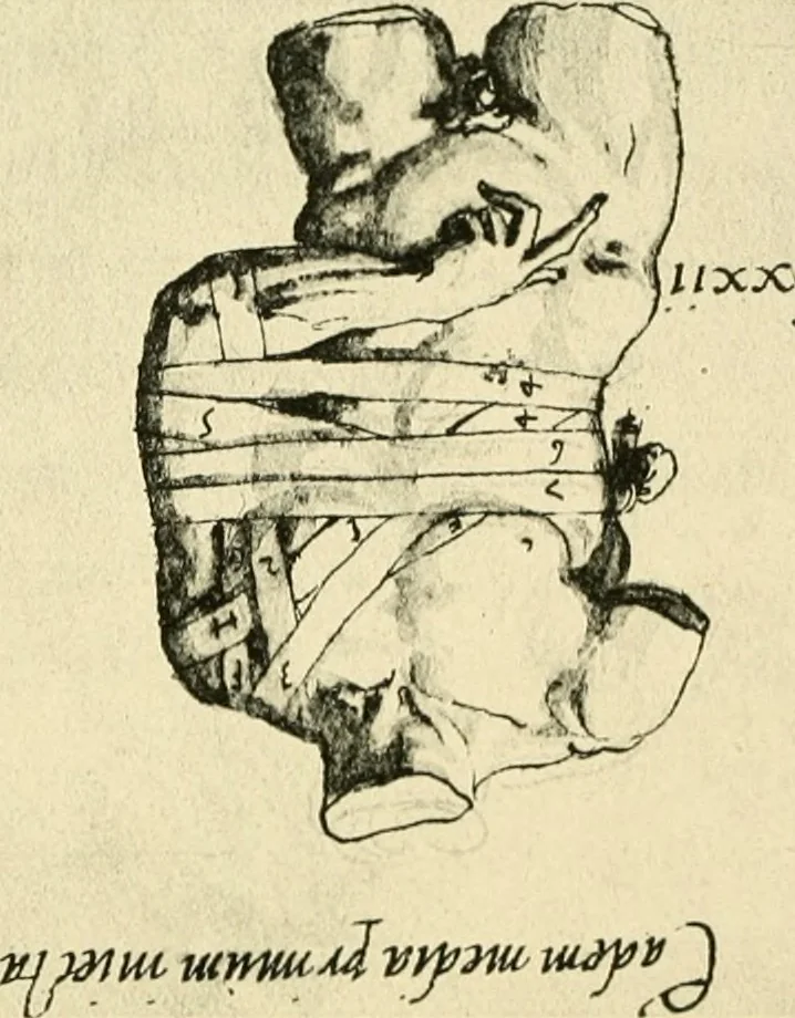 An illustration from Collection de chirurgiens grecs avec dessins attribués au Primatice. Reproduction réduite des 200 dessins du Manuscrit latin 6866 de la Bibliothèque nationale, 1908, leaf 112