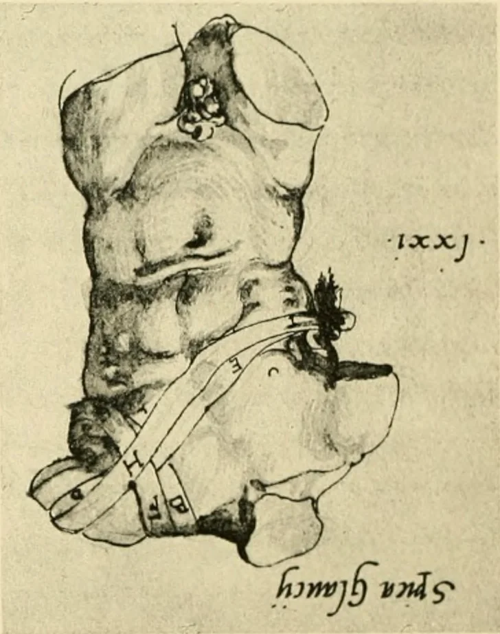 An illustration from Collection de chirurgiens grecs avec dessins attribués au Primatice. Reproduction réduite des 200 dessins du Manuscrit latin 6866 de la Bibliothèque nationale, 1908, leaf 112