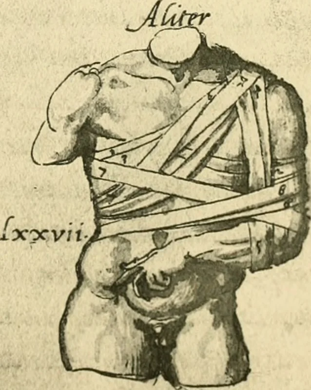 An illustration from Collection de chirurgiens grecs avec dessins attribués au Primatice. Reproduction réduite des 200 dessins du Manuscrit latin 6866 de la Bibliothèque nationale, 1908, leaf 114