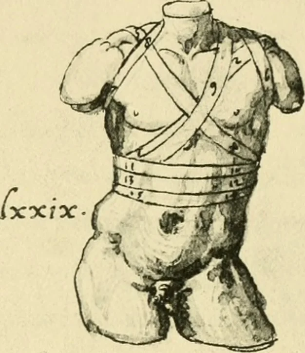 An illustration from Collection de chirurgiens grecs avec dessins attribués au Primatice. Reproduction réduite des 200 dessins du Manuscrit latin 6866 de la Bibliothèque nationale, 1908, leaf 116