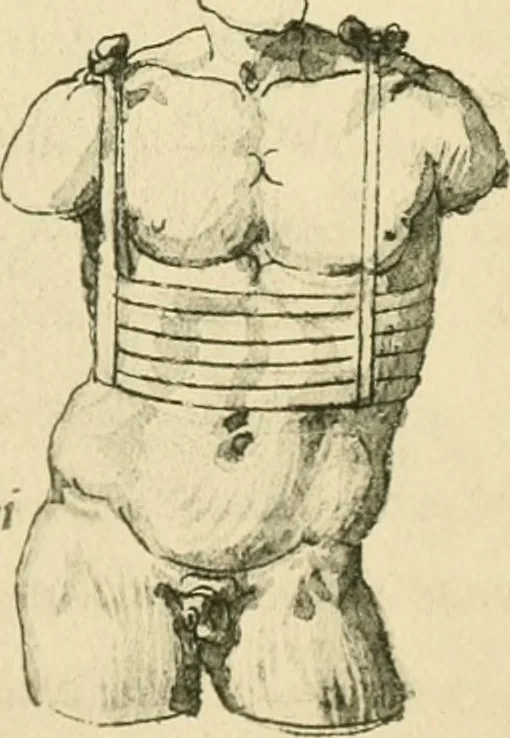 An illustration from Collection de chirurgiens grecs avec dessins attribués au Primatice. Reproduction réduite des 200 dessins du Manuscrit latin 6866 de la Bibliothèque nationale, 1908, leaf 116
