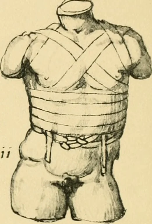 An illustration from Collection de chirurgiens grecs avec dessins attribués au Primatice. Reproduction réduite des 200 dessins du Manuscrit latin 6866 de la Bibliothèque nationale, 1908, leaf 118