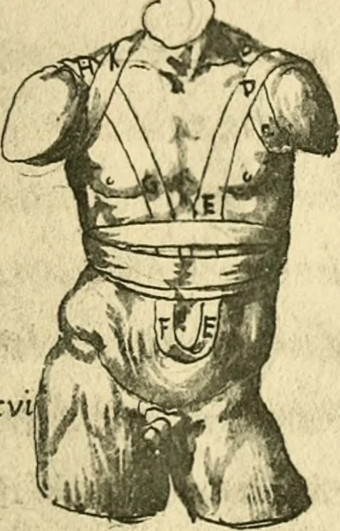 An illustration from Collection de chirurgiens grecs avec dessins attribués au Primatice. Reproduction réduite des 200 dessins du Manuscrit latin 6866 de la Bibliothèque nationale, 1908, leaf 120