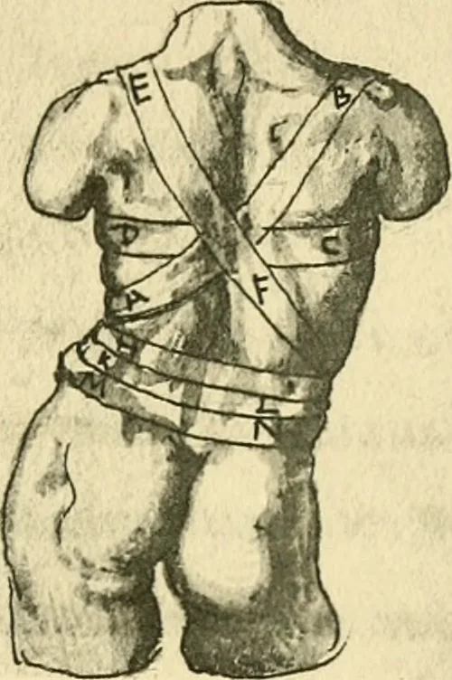 An illustration from Collection de chirurgiens grecs avec dessins attribués au Primatice. Reproduction réduite des 200 dessins du Manuscrit latin 6866 de la Bibliothèque nationale, 1908, leaf 120