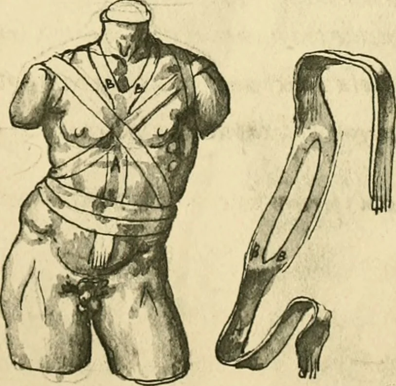 An illustration from Collection de chirurgiens grecs avec dessins attribués au Primatice. Reproduction réduite des 200 dessins du Manuscrit latin 6866 de la Bibliothèque nationale, 1908, leaf 120