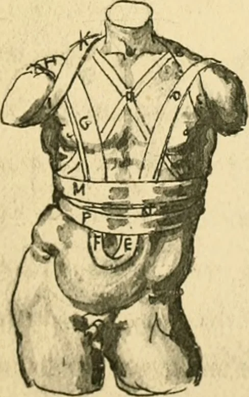 An illustration from Collection de chirurgiens grecs avec dessins attribués au Primatice. Reproduction réduite des 200 dessins du Manuscrit latin 6866 de la Bibliothèque nationale, 1908, leaf 122