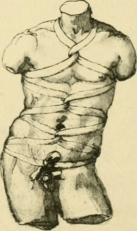 An illustration from Collection de chirurgiens grecs avec dessins attribués au Primatice. Reproduction réduite des 200 dessins du Manuscrit latin 6866 de la Bibliothèque nationale, 1908, leaf 124