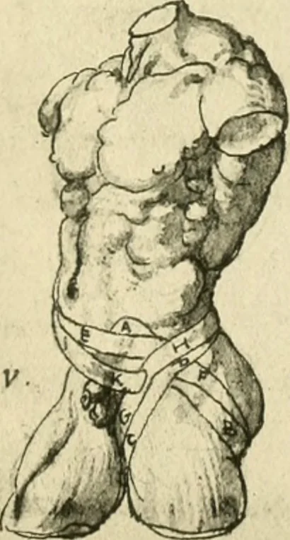 An illustration from Collection de chirurgiens grecs avec dessins attribués au Primatice. Reproduction réduite des 200 dessins du Manuscrit latin 6866 de la Bibliothèque nationale, 1908, leaf 128