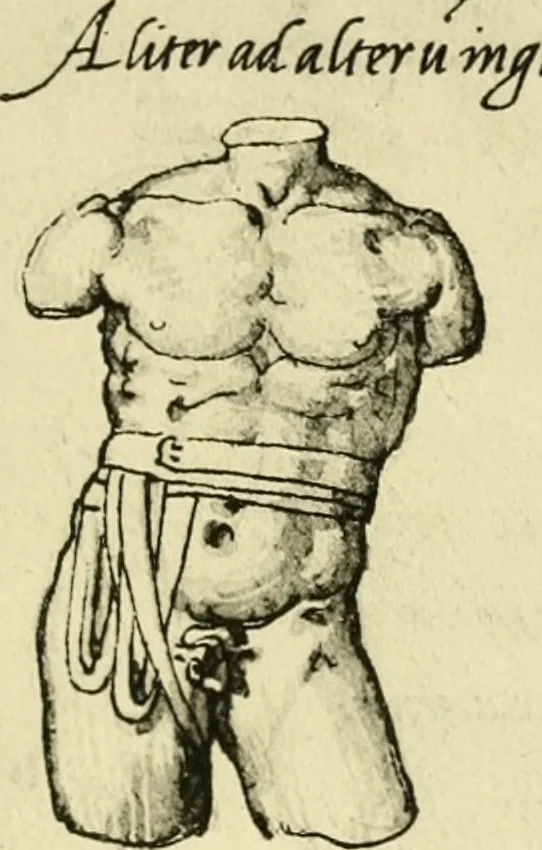 An illustration from Collection de chirurgiens grecs avec dessins attribués au Primatice. Reproduction réduite des 200 dessins du Manuscrit latin 6866 de la Bibliothèque nationale, 1908, leaf 130