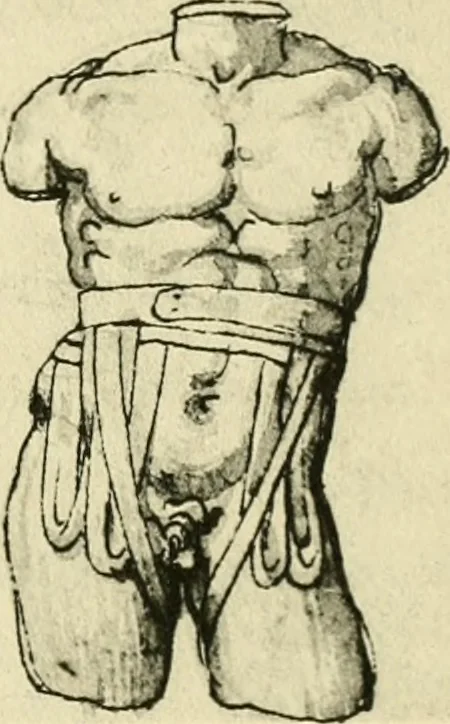 An illustration from Collection de chirurgiens grecs avec dessins attribués au Primatice. Reproduction réduite des 200 dessins du Manuscrit latin 6866 de la Bibliothèque nationale, 1908, leaf 130