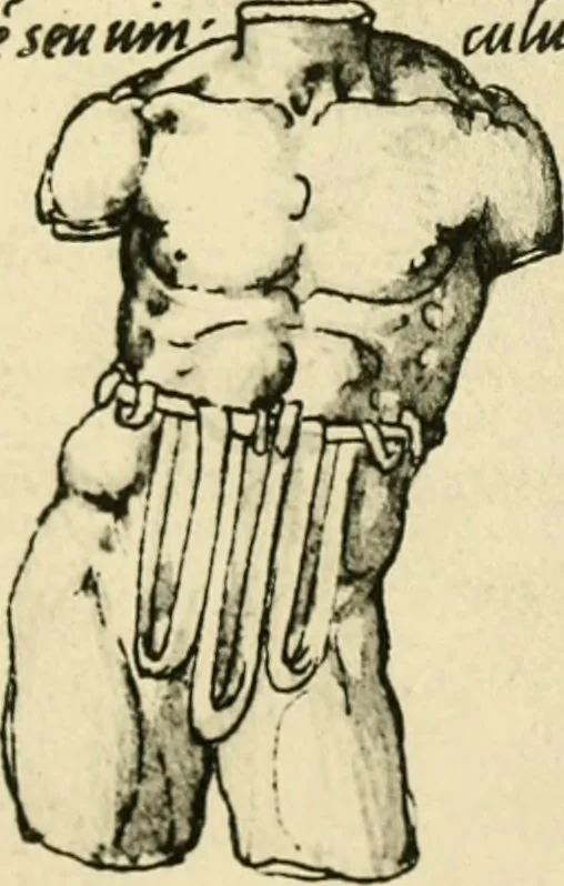 An illustration from Collection de chirurgiens grecs avec dessins attribués au Primatice. Reproduction réduite des 200 dessins du Manuscrit latin 6866 de la Bibliothèque nationale, 1908, leaf 130