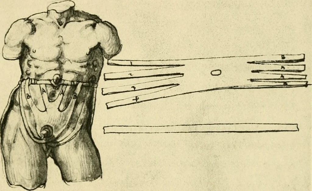 An illustration from Collection de chirurgiens grecs avec dessins attribués au Primatice. Reproduction réduite des 200 dessins du Manuscrit latin 6866 de la Bibliothèque nationale, 1908, leaf 136