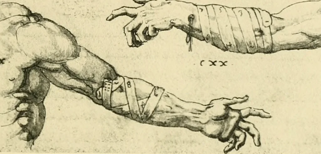 An illustration from Collection de chirurgiens grecs avec dessins attribués au Primatice. Reproduction réduite des 200 dessins du Manuscrit latin 6866 de la Bibliothèque nationale, 1908, leaf 138
