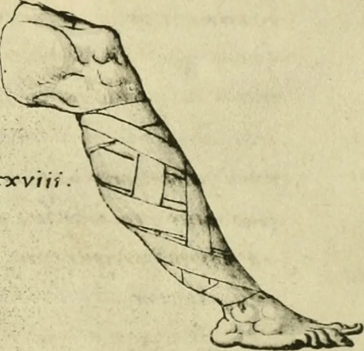 An illustration from Collection de chirurgiens grecs avec dessins attribués au Primatice. Reproduction réduite des 200 dessins du Manuscrit latin 6866 de la Bibliothèque nationale, 1908, leaf 142