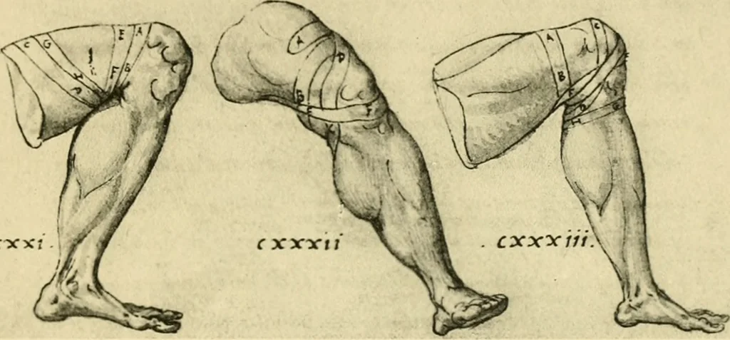 An illustration from Collection de chirurgiens grecs avec dessins attribués au Primatice. Reproduction réduite des 200 dessins du Manuscrit latin 6866 de la Bibliothèque nationale, 1908, leaf 144