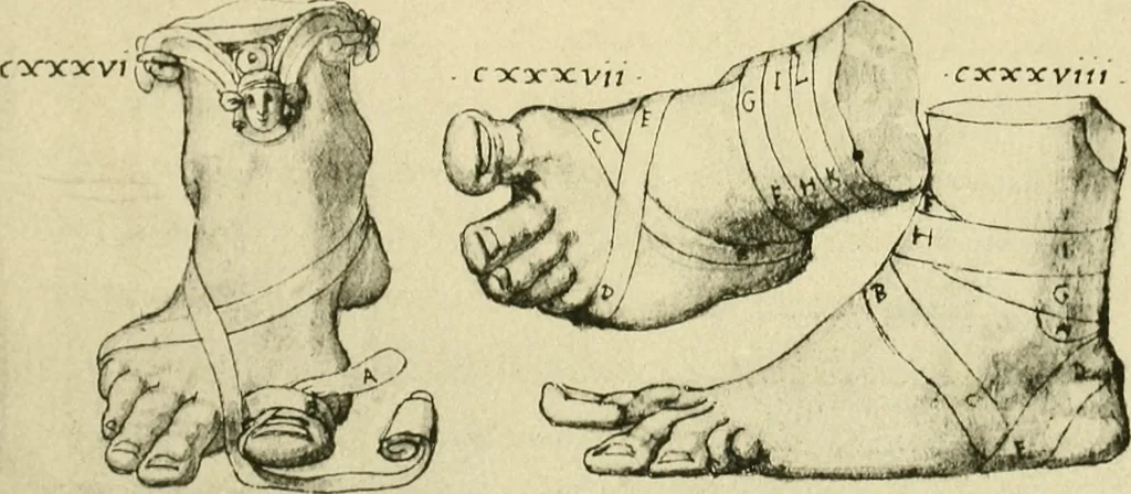 An illustration from Collection de chirurgiens grecs avec dessins attribués au Primatice. Reproduction réduite des 200 dessins du Manuscrit latin 6866 de la Bibliothèque nationale, 1908, leaf 146