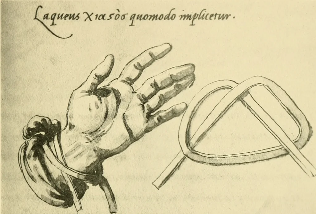An illustration from Collection de chirurgiens grecs avec dessins attribués au Primatice. Reproduction réduite des 200 dessins du Manuscrit latin 6866 de la Bibliothèque nationale, 1908, leaf 150