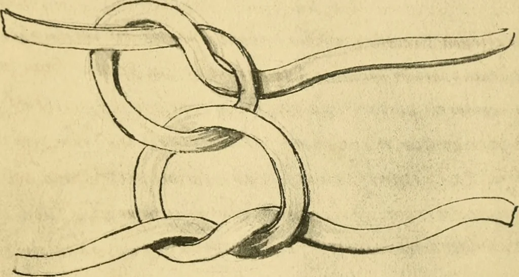 An illustration from Collection de chirurgiens grecs avec dessins attribués au Primatice. Reproduction réduite des 200 dessins du Manuscrit latin 6866 de la Bibliothèque nationale, 1908, leaf 154