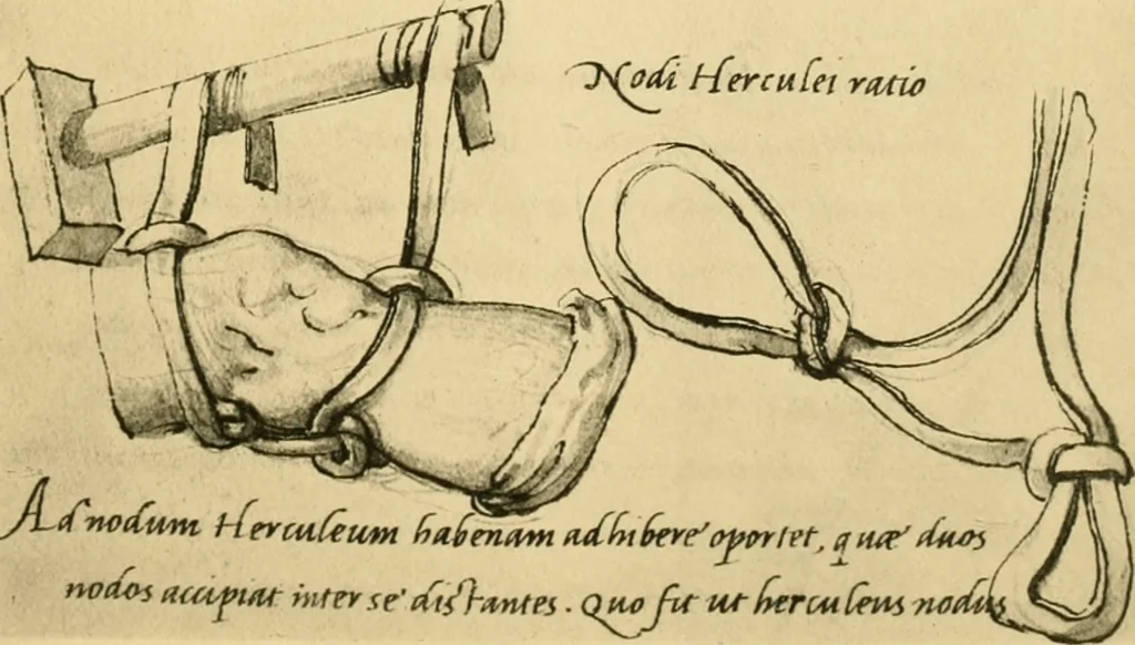 An illustration from Collection de chirurgiens grecs avec dessins attribués au Primatice. Reproduction réduite des 200 dessins du Manuscrit latin 6866 de la Bibliothèque nationale, 1908, leaf 154