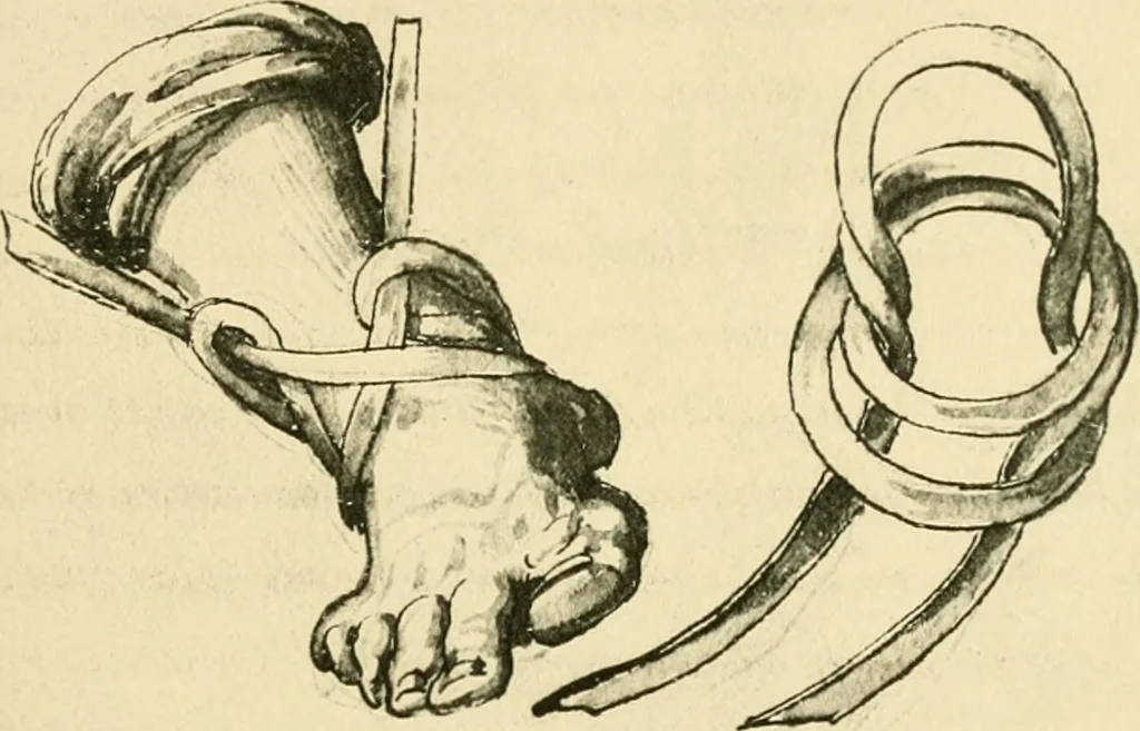 An illustration from Collection de chirurgiens grecs avec dessins attribués au Primatice. Reproduction réduite des 200 dessins du Manuscrit latin 6866 de la Bibliothèque nationale, 1908, leaf 156