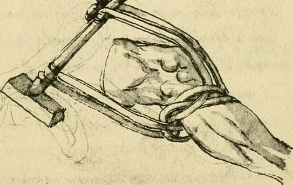 An illustration from Collection de chirurgiens grecs avec dessins attribués au Primatice. Reproduction réduite des 200 dessins du Manuscrit latin 6866 de la Bibliothèque nationale, 1908, leaf 156