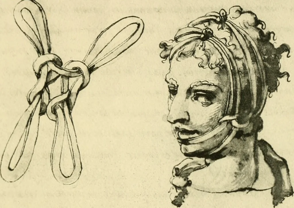 An illustration from Collection de chirurgiens grecs avec dessins attribués au Primatice. Reproduction réduite des 200 dessins du Manuscrit latin 6866 de la Bibliothèque nationale, 1908, leaf 160