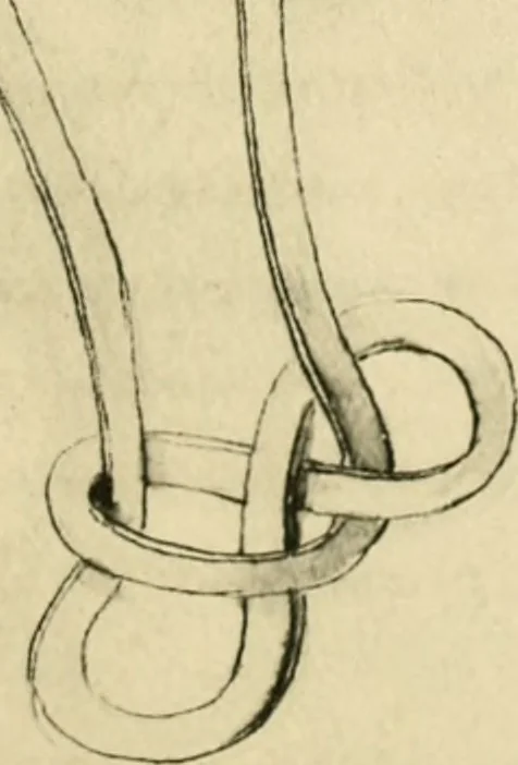 An illustration from Collection de chirurgiens grecs avec dessins attribués au Primatice. Reproduction réduite des 200 dessins du Manuscrit latin 6866 de la Bibliothèque nationale, 1908, leaf 160