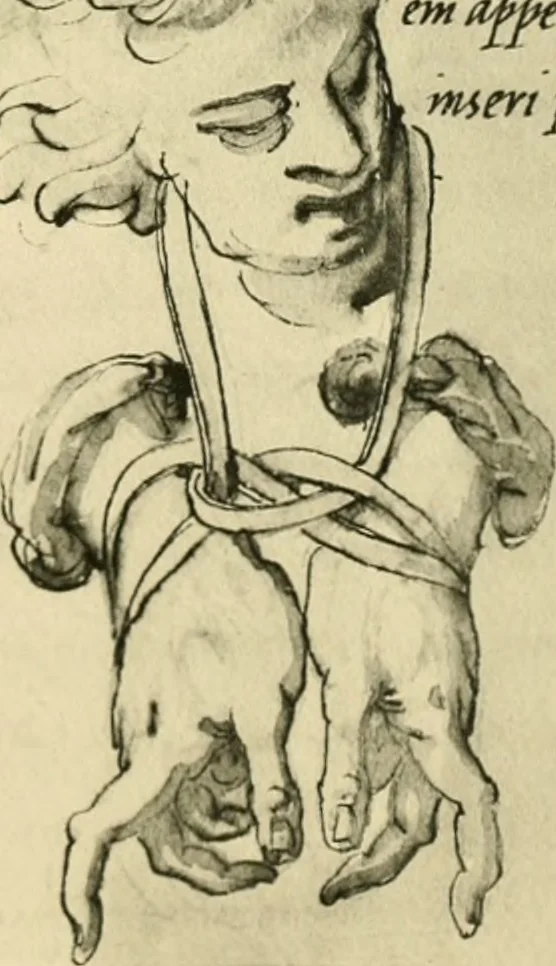 An illustration from Collection de chirurgiens grecs avec dessins attribués au Primatice. Reproduction réduite des 200 dessins du Manuscrit latin 6866 de la Bibliothèque nationale, 1908, leaf 160