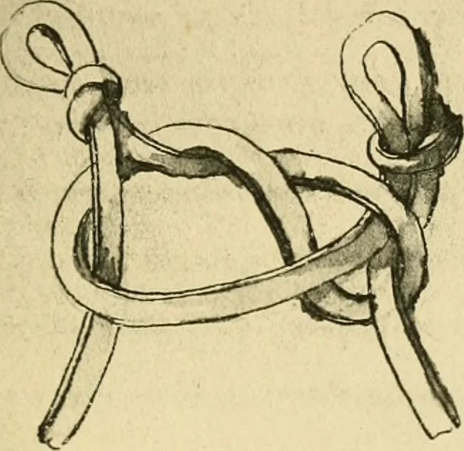 An illustration from Collection de chirurgiens grecs avec dessins attribués au Primatice. Reproduction réduite des 200 dessins du Manuscrit latin 6866 de la Bibliothèque nationale, 1908, leaf 162