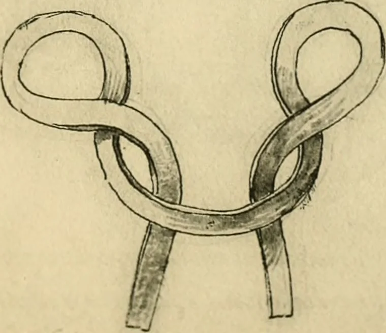 An illustration from Collection de chirurgiens grecs avec dessins attribués au Primatice. Reproduction réduite des 200 dessins du Manuscrit latin 6866 de la Bibliothèque nationale, 1908, leaf 164