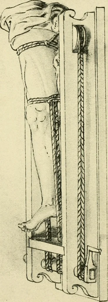 An illustration from Collection de chirurgiens grecs avec dessins attribués au Primatice. Reproduction réduite des 200 dessins du Manuscrit latin 6866 de la Bibliothèque nationale, 1908, leaf 166