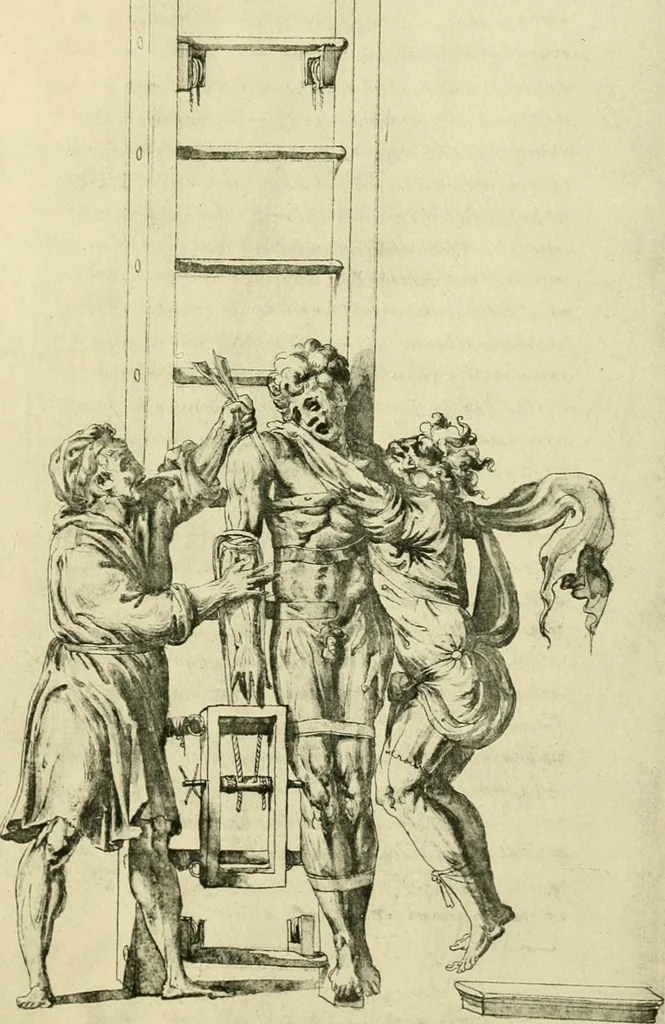 An illustration from Collection de chirurgiens grecs avec dessins attribués au Primatice. Reproduction réduite des 200 dessins du Manuscrit latin 6866 de la Bibliothèque nationale, 1908, leaf 174