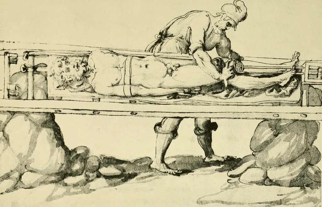 An illustration from Collection de chirurgiens grecs avec dessins attribués au Primatice. Reproduction réduite des 200 dessins du Manuscrit latin 6866 de la Bibliothèque nationale, 1908, leaf 192