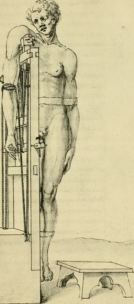 An illustration from Collection de chirurgiens grecs avec dessins attribués au Primatice. Reproduction réduite des 200 dessins du Manuscrit latin 6866 de la Bibliothèque nationale, 1908, leaf 206