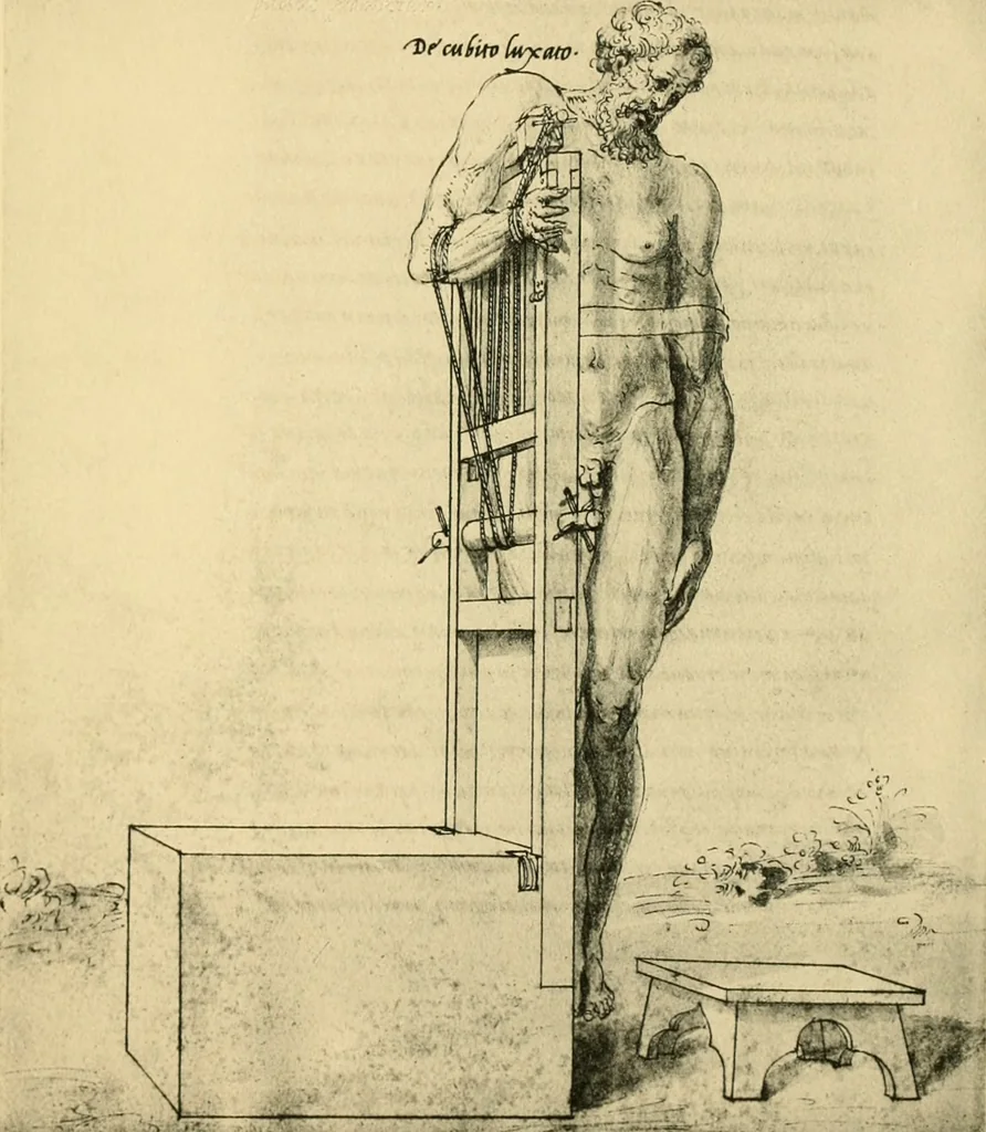 An illustration from Collection de chirurgiens grecs avec dessins attribués au Primatice. Reproduction réduite des 200 dessins du Manuscrit latin 6866 de la Bibliothèque nationale, 1908, leaf 210