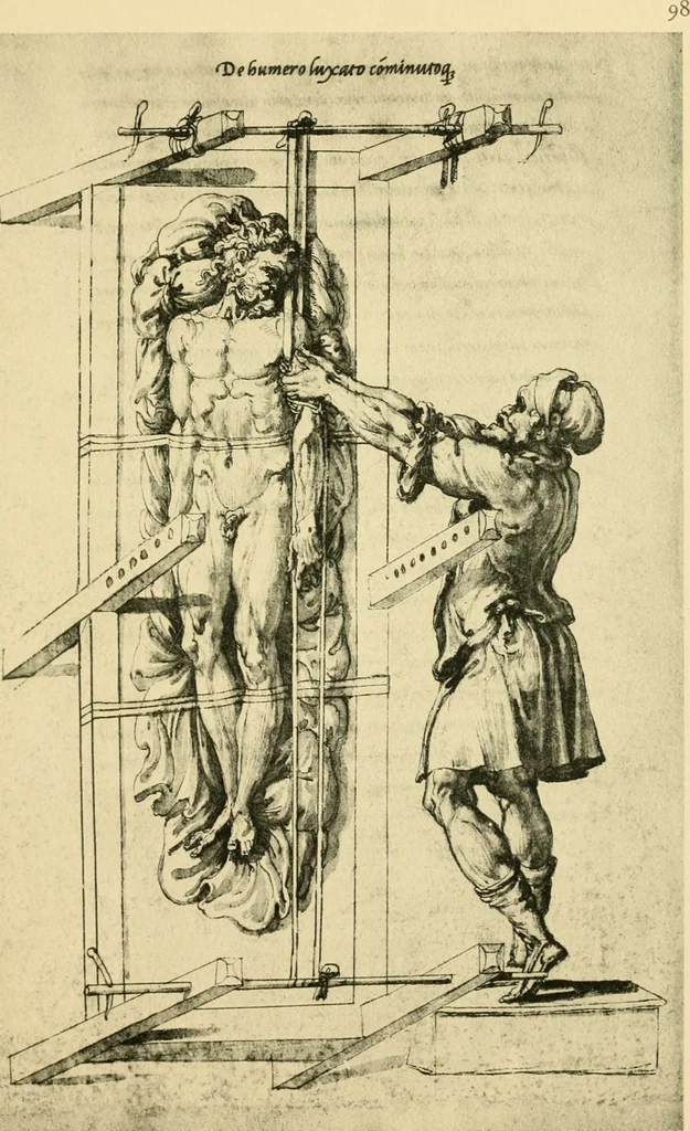 An illustration from Collection de chirurgiens grecs avec dessins attribués au Primatice. Reproduction réduite des 200 dessins du Manuscrit latin 6866 de la Bibliothèque nationale, 1908, leaf 218