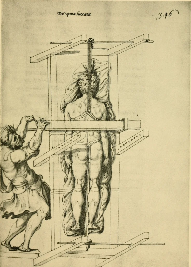 An illustration from Collection de chirurgiens grecs avec dessins attribués au Primatice. Reproduction réduite des 200 dessins du Manuscrit latin 6866 de la Bibliothèque nationale, 1908, leaf 224