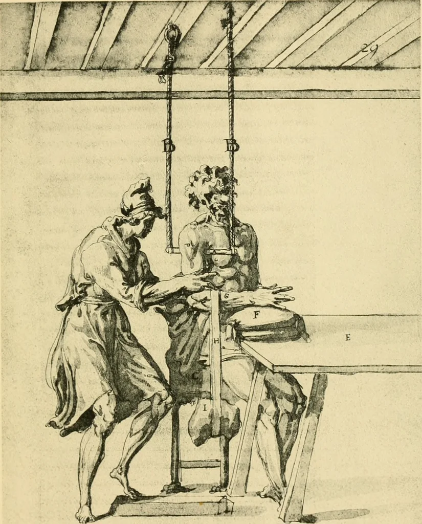 An illustration from Collection de chirurgiens grecs avec dessins attribués au Primatice. Reproduction réduite des 200 dessins du Manuscrit latin 6866 de la Bibliothèque nationale, 1908, leaf 24