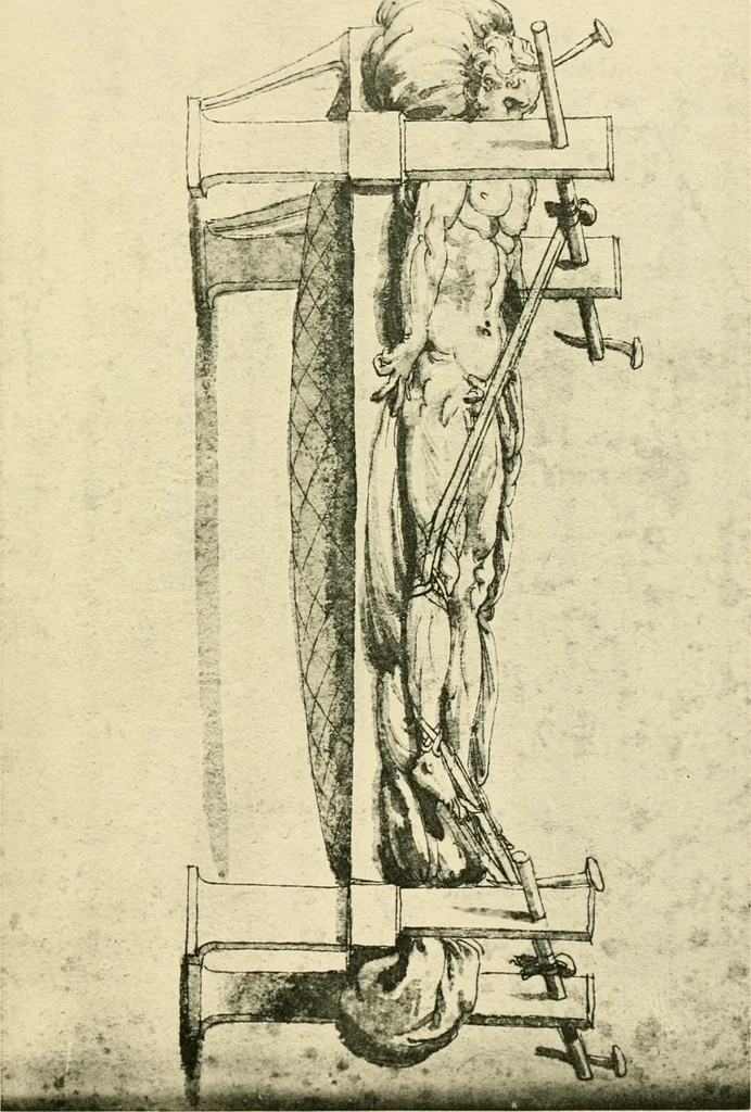 An illustration from Collection de chirurgiens grecs avec dessins attribués au Primatice. Reproduction réduite des 200 dessins du Manuscrit latin 6866 de la Bibliothèque nationale, 1908, leaf 36