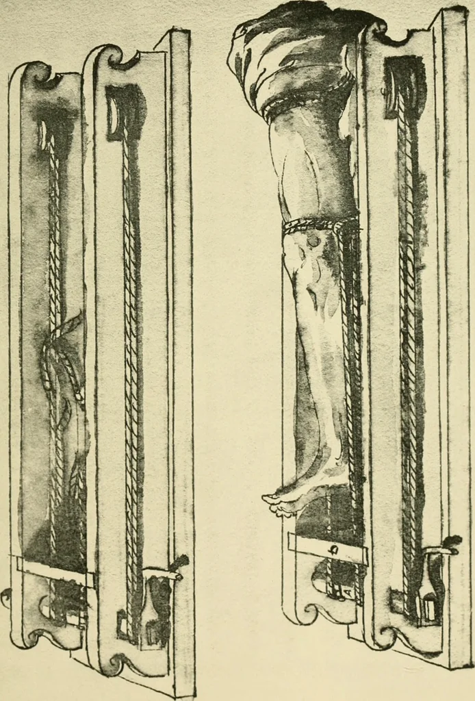 An illustration from Collection de chirurgiens grecs avec dessins attribués au Primatice. Reproduction réduite des 200 dessins du Manuscrit latin 6866 de la Bibliothèque nationale, 1908, leaf 38