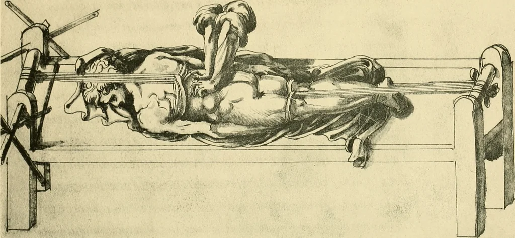 An illustration from Collection de chirurgiens grecs avec dessins attribués au Primatice. Reproduction réduite des 200 dessins du Manuscrit latin 6866 de la Bibliothèque nationale, 1908, leaf 66