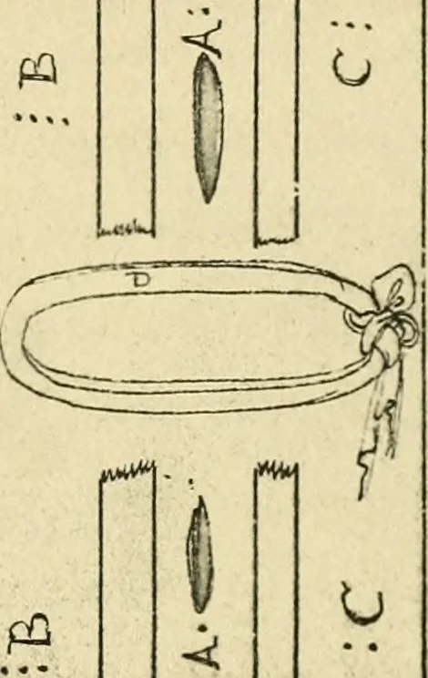 An illustration from Collection de chirurgiens grecs avec dessins attribués au Primatice. Reproduction réduite des 200 dessins du Manuscrit latin 6866 de la Bibliothèque nationale, 1908, leaf 72