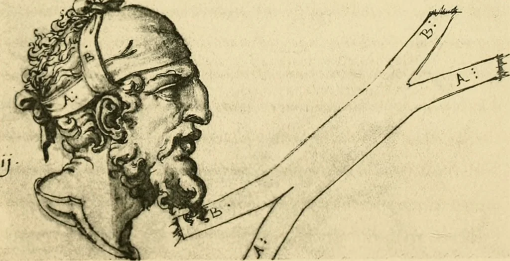 An illustration from Collection de chirurgiens grecs avec dessins attribués au Primatice. Reproduction réduite des 200 dessins du Manuscrit latin 6866 de la Bibliothèque nationale, 1908, leaf 72