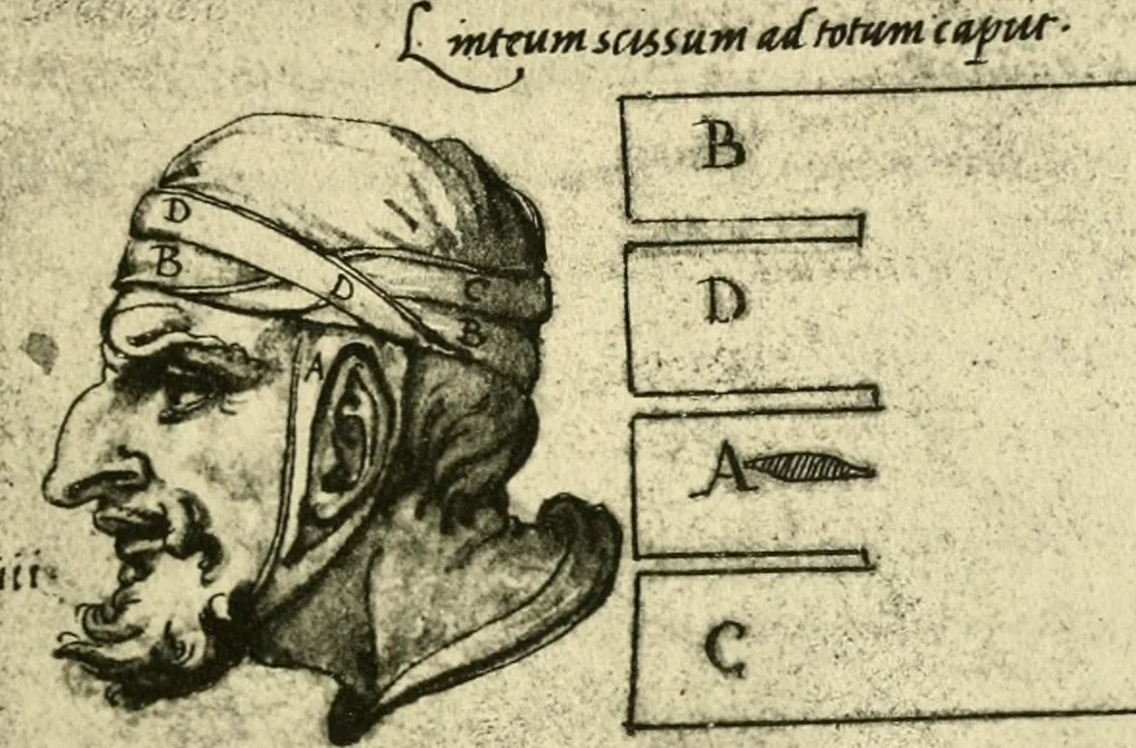 An illustration from Collection de chirurgiens grecs avec dessins attribués au Primatice. Reproduction réduite des 200 dessins du Manuscrit latin 6866 de la Bibliothèque nationale, 1908, leaf 74