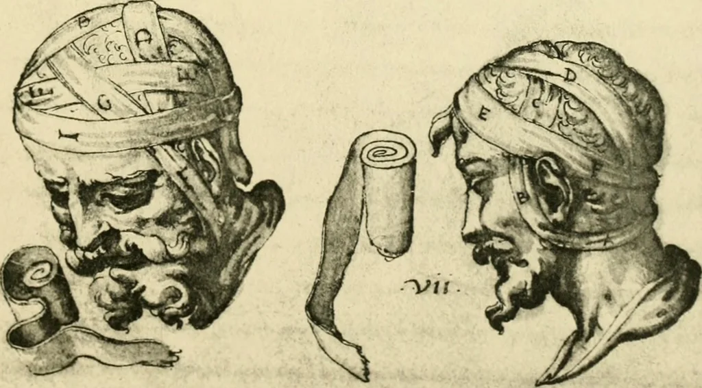 An illustration from Collection de chirurgiens grecs avec dessins attribués au Primatice. Reproduction réduite des 200 dessins du Manuscrit latin 6866 de la Bibliothèque nationale, 1908, leaf 76