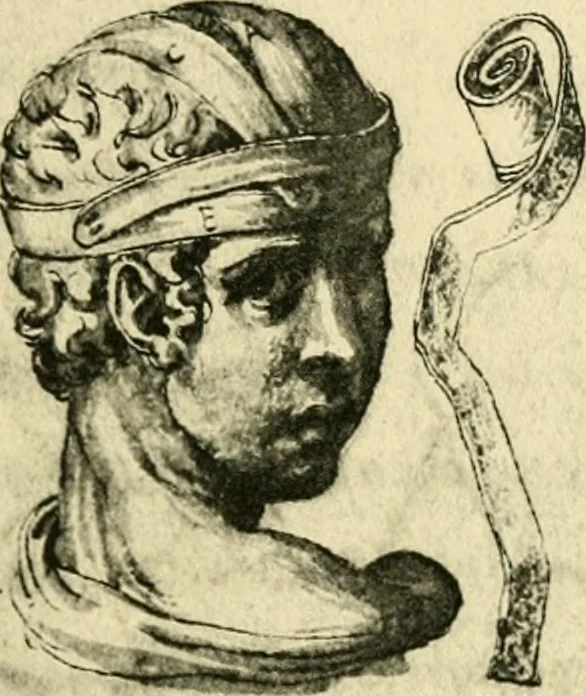 An illustration from Collection de chirurgiens grecs avec dessins attribués au Primatice. Reproduction réduite des 200 dessins du Manuscrit latin 6866 de la Bibliothèque nationale, 1908, leaf 78