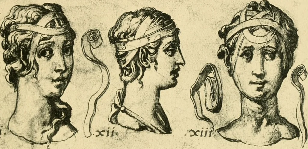An illustration from Collection de chirurgiens grecs avec dessins attribués au Primatice. Reproduction réduite des 200 dessins du Manuscrit latin 6866 de la Bibliothèque nationale, 1908, leaf 80